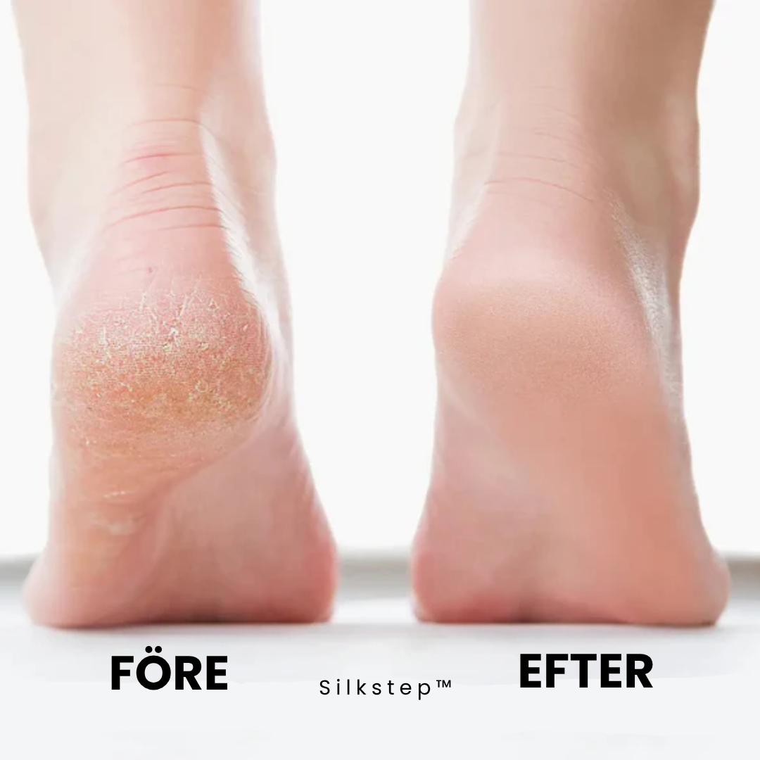 Zofti Silkstep™ - Mjuka fötter utan dyra salongsbesök