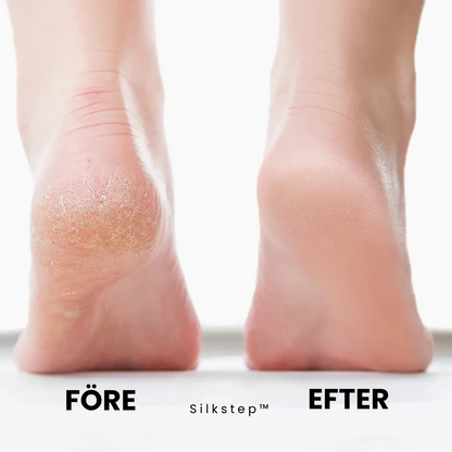 Zofti Silkstep™ - Mjuka fötter utan dyra salongsbesök